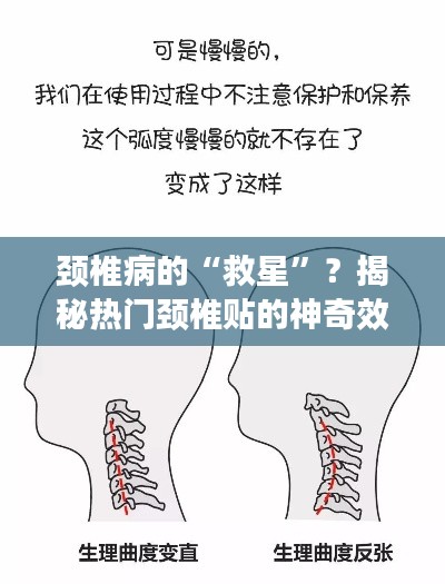 颈椎病的“救星”？揭秘热门颈椎贴的神奇效果与使用指南